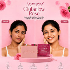 Ayurvedika Glutaglow Rose skincare products with a 'Before' and 'After' comparison on a pink background with roses.